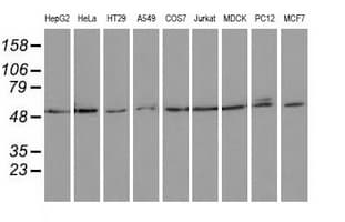 Monoclonal Mouse anti-Human PSMC3 Antibody (clone OTI1C10, IHC, IF, WB)
