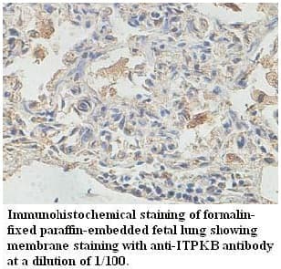 ITPKB Antibody (aa287-446)