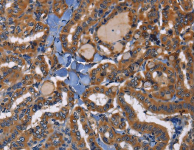 EPHB6 / EPH Receptor B6 Antibody
