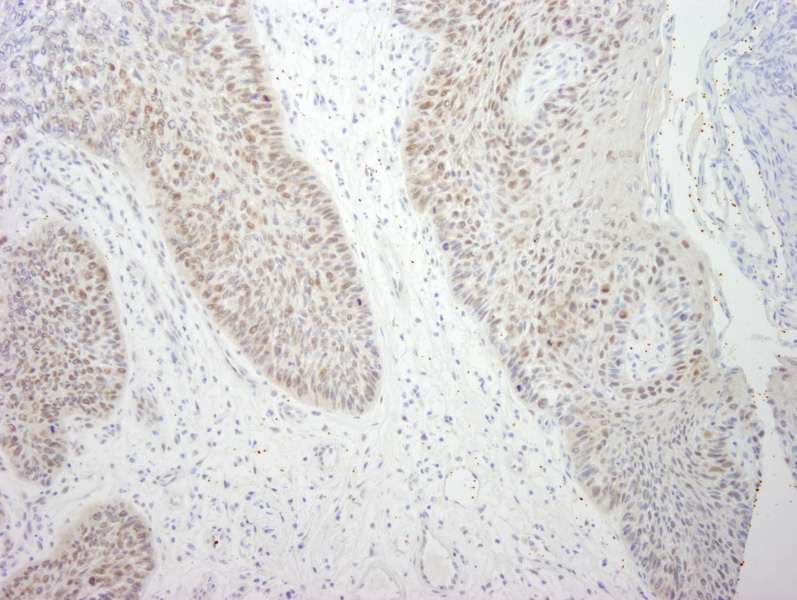 Polyclonal Rabbit anti-Human DDX21 Antibody (aa725-C-term, IHC)