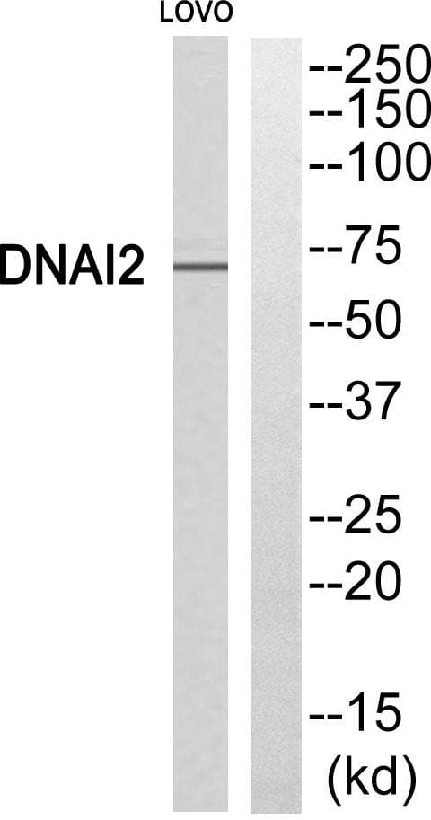 CILD9 / DNAI2 Antibody