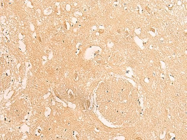 IFITM2 Antibody