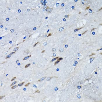 BLZF1 Antibody