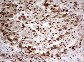 FBXW7 / FBW7 Antibody (aa1-354, clone OTI6F5)