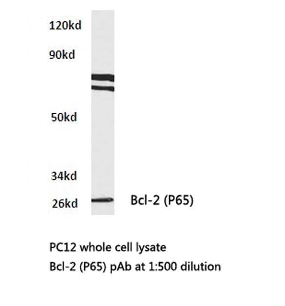 BCL2 / Bcl-2 Antibody (Pro65)