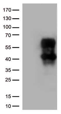 HAVCR2 / TIM-3 Antibody (clone OTI9H6)
