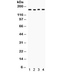 Polyclonal Rabbit anti-Human HKDC1 Antibody (WB)