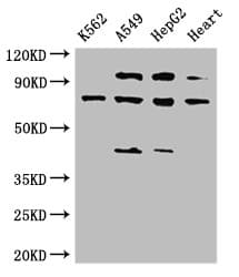 IHC-plus™ IL12RB1 / CD212 Antibody