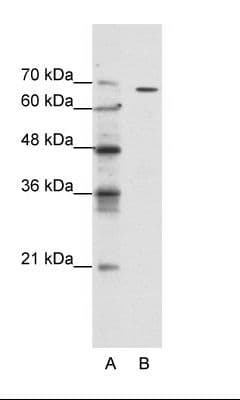 GABRQ / THETA Antibody (aa31-80)