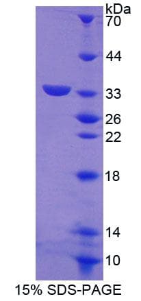 Mouse ABCG8 Protein (Recombinant His-T7, N-terminus)