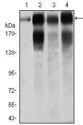 ITGB4 / Integrin Beta 4 Antibody (Amino Acid: 1619-1822, clone 10B10D5)