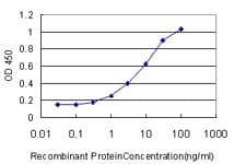 Monoclonal Mouse anti-Human SOX4 Antibody (clone 2C5)