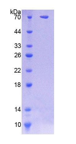 Human SGSH Protein (Recombinant His-GST)