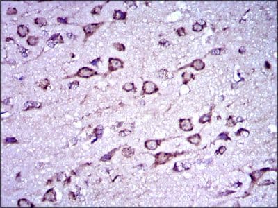 Monoclonal Mouse anti-Human DCX / Doublecortin Antibody (clone 2G5, Amino Acid: 362-411, IHC, IF, WB)