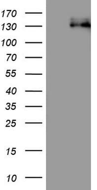 CDH4 / R Cadherin Antibody (aa170-428, clone OTI3C10)