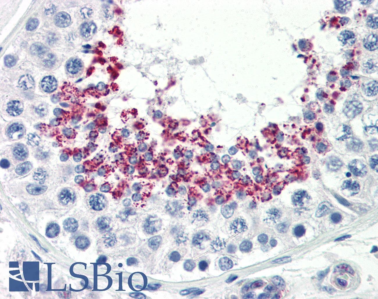 KLB / Beta Klotho Antibody (Internal)
