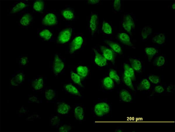 IHC-plus™ SAFB1 / SAFB Antibody (clone 5A11)