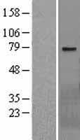 WBSCR17 Protein (Over-Expression Lysate Myc-DDK (Flag))