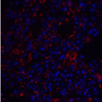 IHC-plus™ Polyclonal Rabbit anti-Human TM4SF1 Antibody (IHC, IF, WB)