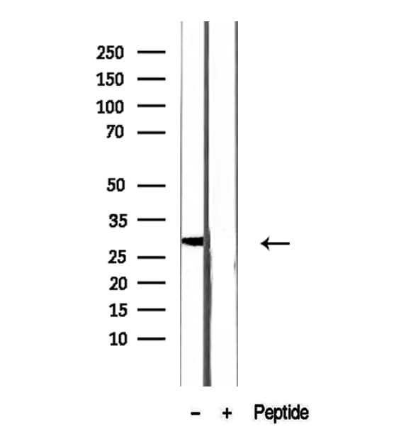CRISP2 / TSP1 Antibody