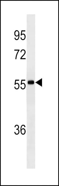 Mouse Anti-Human IgA Secondary Antibody