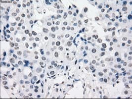 Monoclonal Mouse anti-Human PRKY Antibody (clone OTI4G7, Carrier-free, IHC, IF, WB)