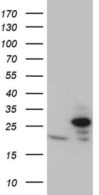 TIM23 Antibody (clone OTI2F5)