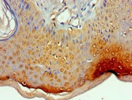 ITGA9 / Integrin Alpha 9 Antibody (aa30-250)