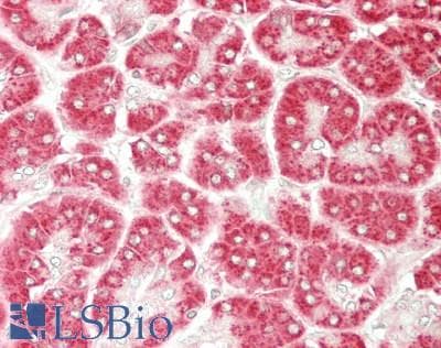 PathPlus™ Polyclonal Rabbit anti-Human BCL2L2 / Bcl-w Antibody (IHC, WB)
