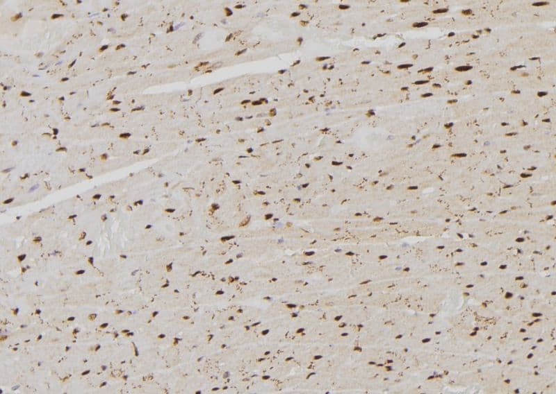 RPLP0 Antibody