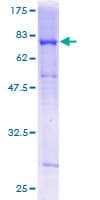Human RBBP4 / RBAP48 Protein (Recombinant GST)