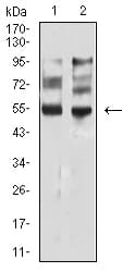 Monoclonal Mouse anti-Human MITF Antibody (clone 8F1G5, WB)