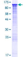 Human MAPK6 / ERK3 Protein (Recombinant GST)