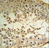 Polyclonal Rabbit anti-Human PRAME Antibody (aa476-502, IHC, WB)