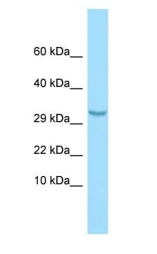 C1QTNF3 / CTRP3 Antibody (aa33-82)