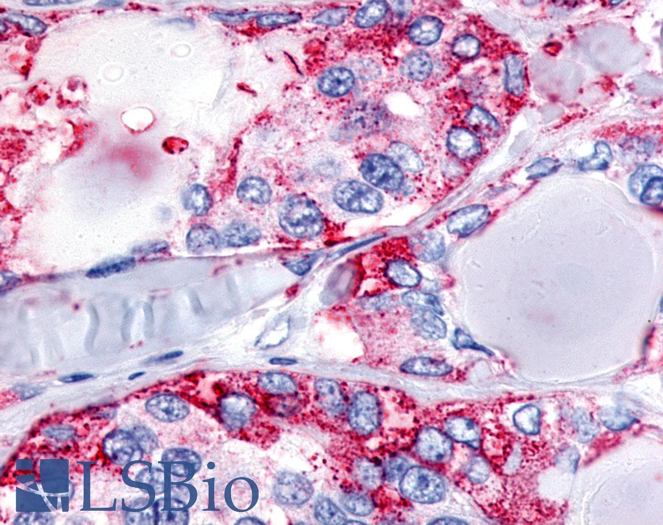 PathPlus™ CALCR / Calcitonin Receptor Antibody (C-Terminus)