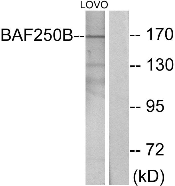ARID1B / BAF250B Antibody