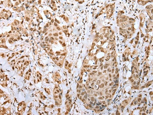 ZNF486 Antibody