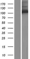 HK1 / Hexokinase 1 Protein (Over-Expression Lysate Myc-DDK (Flag))
