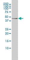 IHC-plus™ TES / Testin Antibody (clone 1G11-B7)
