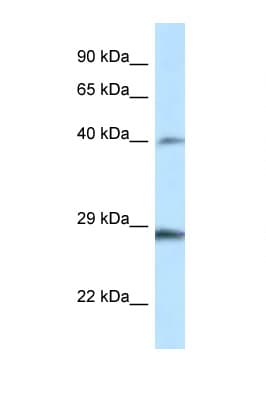 HOXB9 Antibody (aa20-69)