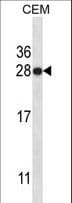 Polyclonal Rabbit anti-Human HMG1 / HMGB1 Antibody (WB)