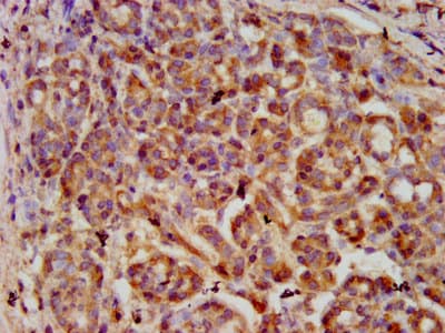 SERPINB4 / SCCA1+2 Antibody