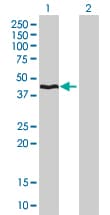 Monoclonal Mouse anti-Human HMBS / PBGD Antibody (clone 3E8, WB)