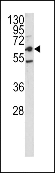 Polyclonal Rabbit anti-Human CD66a / CEACAM1 Antibody (aa50-77, IHC, WB)