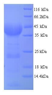 Plasmodium falciparum ABCB1 / MDR1 / P Glycoprotein (Recombinant His)