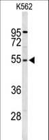RPS6KB2 / S6K2 Antibody