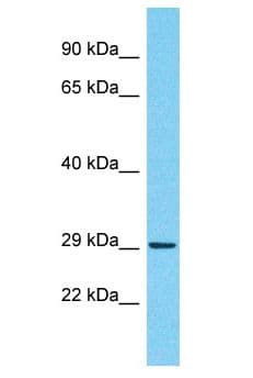 R3HCC1 Antibody (aa164-213)