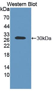 ABCC2 / MRP2 Antibody (aa1300-1534, Biotin)