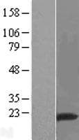 RNF149 Protein (Over-Expression Lysate Myc-DDK (Flag))